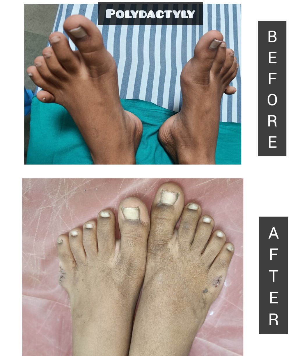Plastic Surgery